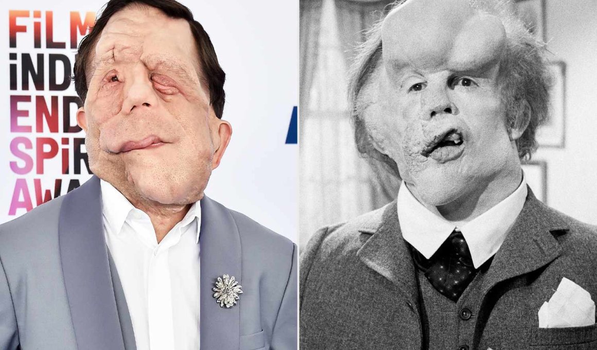 Nέο “The Elephant Man” με τον Άνταμ Πίρσον στον πρωταγωνιστικό ρόλο Nέο “The Elephant Man” με τον Άνταμ Πίρσον στον πρωταγωνιστικό ρόλο