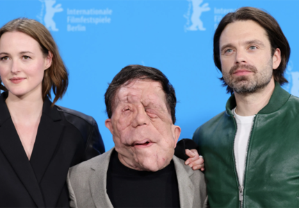 Berlinale 2024: "Όλοι είμαστε διαφορετικοί και όλοι έχουμε τα χάλια μας"