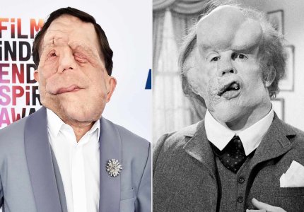 Nέο “The Elephant Man” με τον Άνταμ Πίρσον στον πρωταγωνιστικό ρόλο